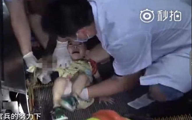 Thang cuốn suýt nghiền đứt cánh tay của bé gái Ảnh 2