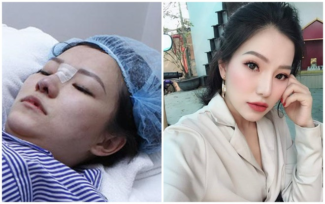 Hậu ly hôn một năm, vợ cũ Lâm Vinh Hải 'tái xuất' với diện mạo xinh đẹp nhờ phẫu thuật thẩm mĩ Ảnh 2