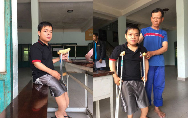 Chuyện cảm động về nam sinh mắc bệnh xương thủy tinh, gần 20 năm từ lớp 1 đến Đại học đều đi nhờ đôi chân của cha mẹ Ảnh 2