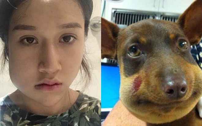 Răng khôn mọc dại, mặt sưng như ong đốt, dân tình sửng sốt vì chủ thớt quá xinh đẹp! Ảnh 2