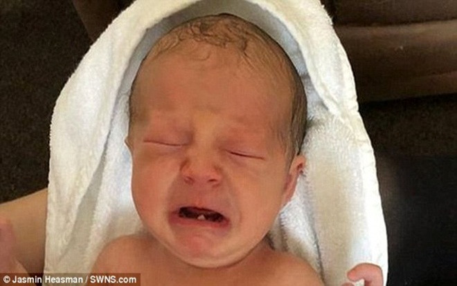 Bà mẹ sợ 'hết hồn' khi phát hiện con gái 12 ngày tuổi đã mọc răng Ảnh 2