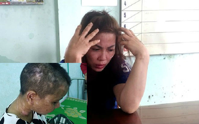 Vụ giúp việc bị tra tấn dã man như thời trung cổ: Nga 'vọc' thừa nhận dùng dao chặt đứt ngón tay nạn nhân Ảnh 2