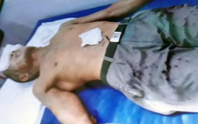 Ông lão 67 tuổi cùng người bán thịt bò bị tạt axit do cùng có tình cảm với một phụ nữ Ảnh 2