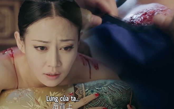 Nếu thắc mắc Cao Quý phi bị bỏng nhưng toàn thân lở loét, hãy đọc để biết về kim trấp trong 'Diên Hi công lược' Ảnh 2