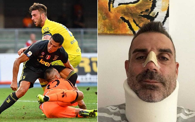 Khiến thủ môn đối phương gãy mũi, Ronaldo được nạn nhân ‘tôn’ làm huyền thoại Ảnh 2