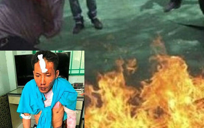 Vụ chồng 'hờ' mua xăng thiêu sống 3 mẹ con: 1 bé gái 12 tuổi đã tử vong Ảnh 2