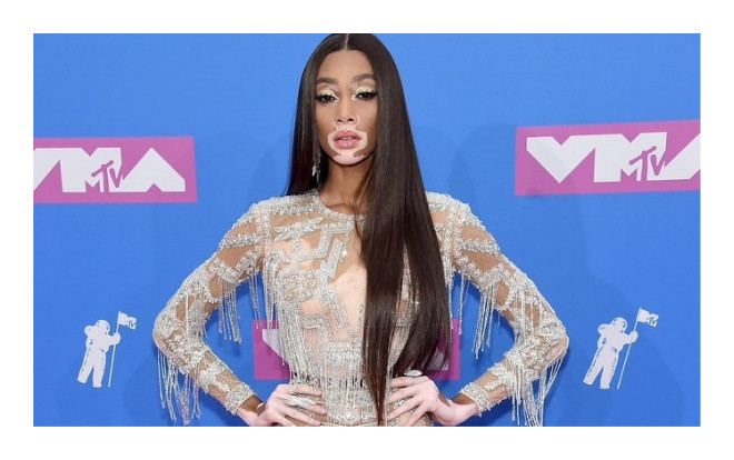 Loạt sao hở bốc lửa gây sốc trên thảm hồng MTV Video Music Awards 2018 Ảnh 2