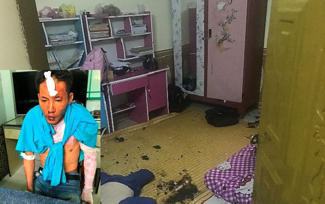 Vụ chồng 'hờ' mua xăng thiêu sống 3 mẹ con: 2 con riêng đã tử vong, người vợ tiên lượng dè dặt Ảnh 2