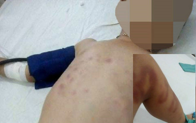 Cha dượng 'hờ' đánh con riêng của vợ dã man dẫn đến hôn mê Ảnh 2