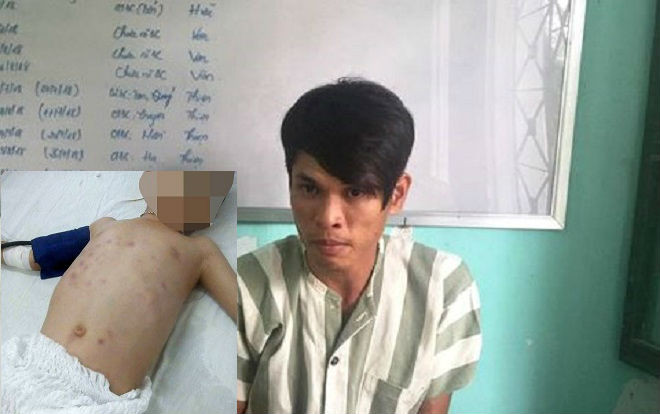 Lời khai đối tượng đánh con riêng của vợ dã man dẫn đến hôn mê Ảnh 2
