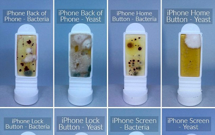 Dựng tóc gáy với những hình ảnh kinh hoàng về vi khuẩn có trên smartphone Ảnh 2