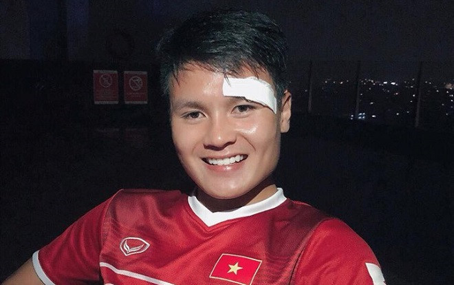 Quang Hải và người yêu đăng hình ảnh đầu tiên sau khi 'đổ máu' trong trận thắng Olympic Syria: 'Vẫn khỏe và đẹp trai nhé!' Ảnh 2