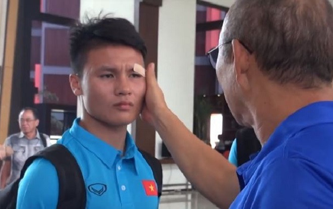 Quang Hải phụng phịu để HLV Park Hang Seo dán lại vết rách ở mắt Ảnh 2