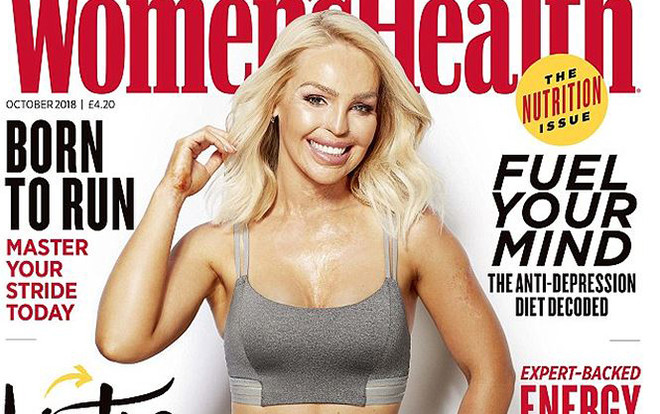 Cựu người mẫu khoe nhan sắc và vóc dáng trên tạp chí sau 10 năm bị bạn trai tạt axit Ảnh 2