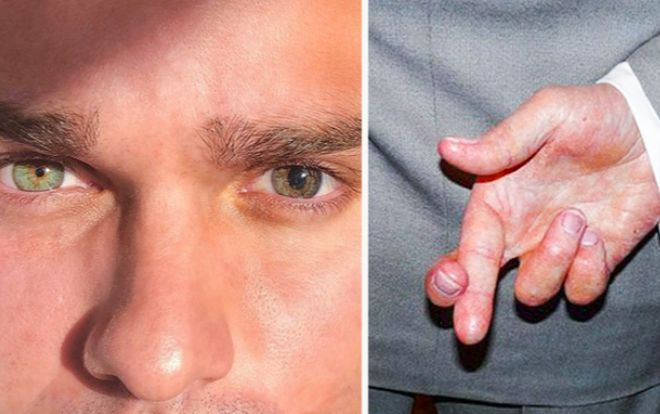 7 siêu năng lực mà chỉ người bị rối loạn lo âu sở hữu Ảnh 2