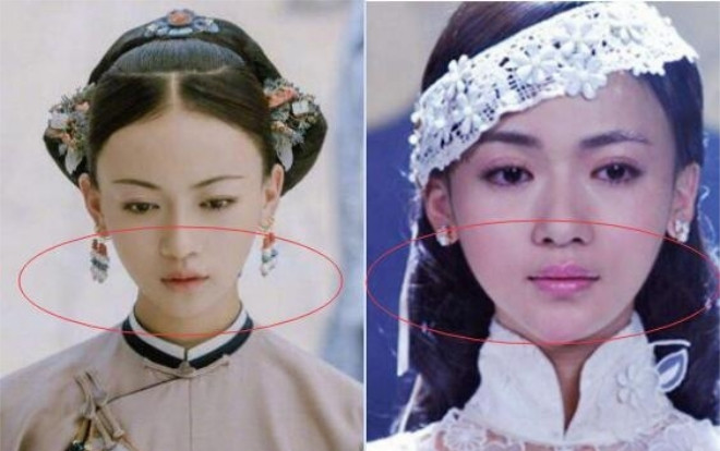 'Ngụy Anh Lạc' Ngô Cẩn Ngôn bị tố độn cằm, gọt mặt V-line, nhan sắc năm xưa khác xa bây giờ Ảnh 2