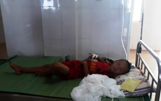 Theo bạn đi bắt ong vò vẽ, một học sinh lớp 3 bị ong đốt nhập viện Ảnh 2