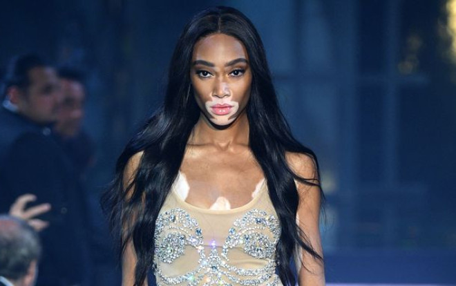 Người mẫu bạch biến đầu tiên trên thế giới gia nhập show trứ danh Victoria's Secret 2018 Ảnh 2