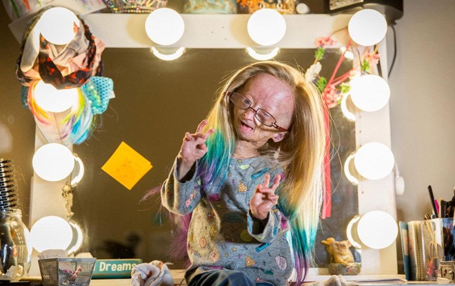 Bé gái mang hình thể lão hóa vẫn trở thành ngôi sao YouTube với hàng triệu người ngưỡng mộ Ảnh 2