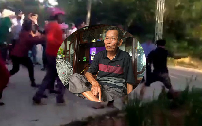 Truy tìm nhóm thanh niên bịt mặt hành hung người dân đến ngất xỉu Ảnh 2