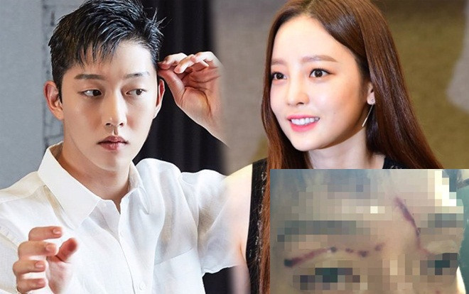 'Shock' khi Goo Hara phá hủy gương mặt 'mỹ nam' của bạn trai - từng được cho là giống Yoo Ah In và Nam Joo Hyuk Ảnh 2