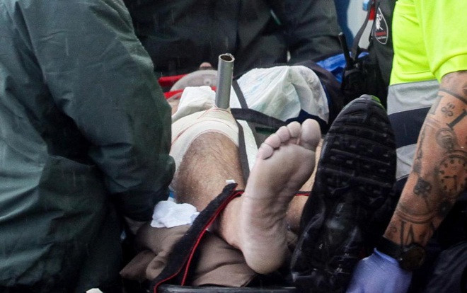 Rơi từ tầng 4, người đàn ông bị cọc ô đâm xuyên qua đầu gối Ảnh 2