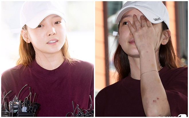 Không ai còn có thể nhận ra đây chính là 'búp bê' Goo Hara sau khi bị bạn trai hành hung Ảnh 2