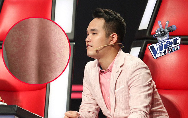 Vắng mặt tại vòng Đối đầu, Khắc Hưng đăng tâm thư: 'Đã mua sẵn mặt nạ nhưng đành nằm bất lực' Ảnh 2