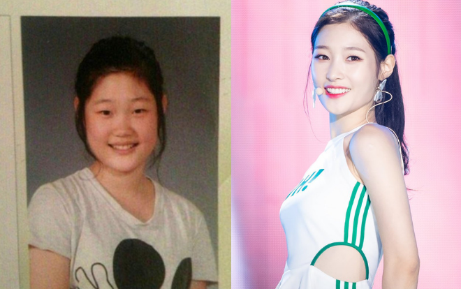 Phẫu thuật thẩm mĩ trong Kpop, người lên đời nhan sắc, người hối hận không kịp Ảnh 2