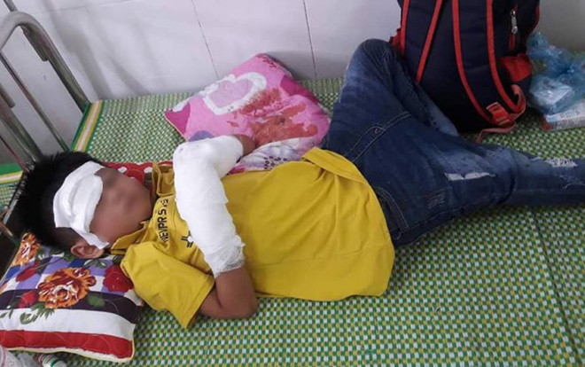 Vụ bé trai dập nát 2 bàn tay vì điện thoại phát nổ: Những lưu ý ai cũng cần nắm rõ để tránh tai nạn đáng tiếc Ảnh 2