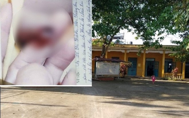 Cô giáo mầm non bị tố vụt chảy máu bộ phận sinh dục bé trai 3 tuổi, nhà trường nói gì? Ảnh 2