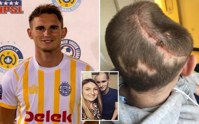 Nam thanh niên sống sót kỳ diệu chỉ với nửa hộp sọ Ảnh 2