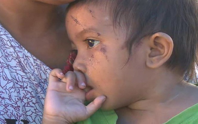 Bé gái 1 tuổi sống sót thần kỳ sau thảm họa kép ở Indonesia Ảnh 2