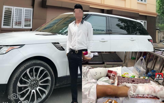 Người đàn ông bị nhóm đối tượng bịt mặt đi ô tô cầm dao chém nát chân trong đêm Ảnh 2