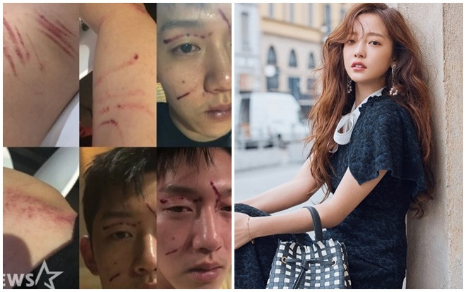 Bạn trai cũ của Goo Hara tiết lộ những hình ảnh sau cuộc ẩu đả và luôn miệng nói mình là nạn nhân Ảnh 2