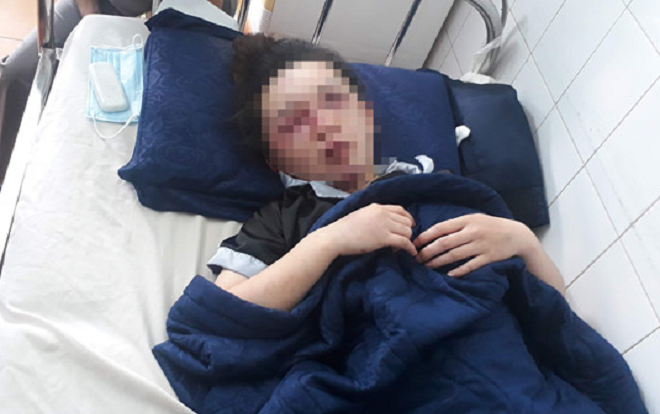 Hé lộ nguyên nhân nữ nhân viên Spa bất ngờ bị nhóm người bắt lên taxi rồi đánh dã man vào vùng mặt Ảnh 2