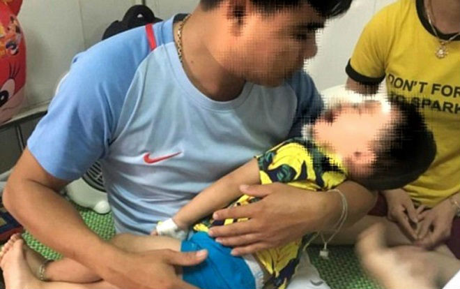 Bị chó Becgie nhà nuôi tấn công bất ngờ, bé trai 2 tuổi tổn thương vùng mặt nghiêm trọng Ảnh 2