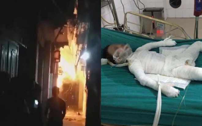 Bé trai 6 tuổi bị bố dượng tẩm xăng đốt nguy kịch: 'Lúc tỉnh vẫn hỏi bố Linh có sao không, nhìn cháu cháy đen không ai cầm được nước mắt' Ảnh 2