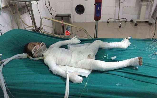 Bố dượng đổ xăng thiêu chết bé trai 6 tuổi ở Hà Nội có thể đối diện án tử hình Ảnh 2