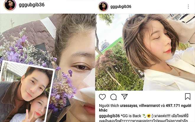 Những hình ảnh mới của nữ diễn viên - MC Thái Lan Gubgib sau khi chỉnh sửa lại mũi Ảnh 2