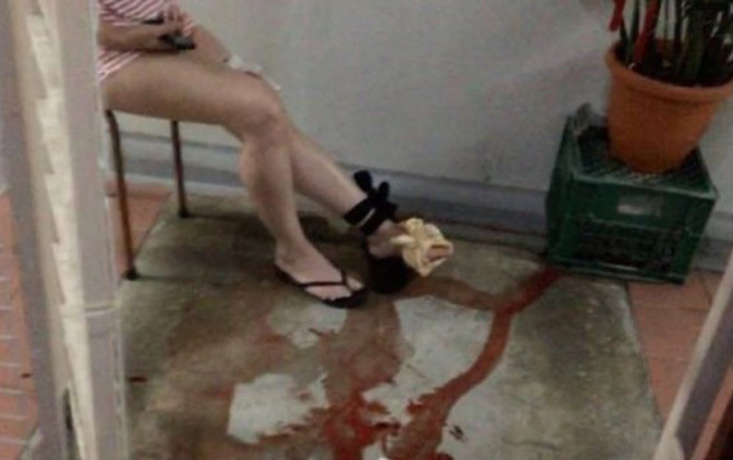 Tưởng bị mèo cào vào chân, người phụ nữ hãi hùng khi nhìn thấy thứ bên dưới Ảnh 2