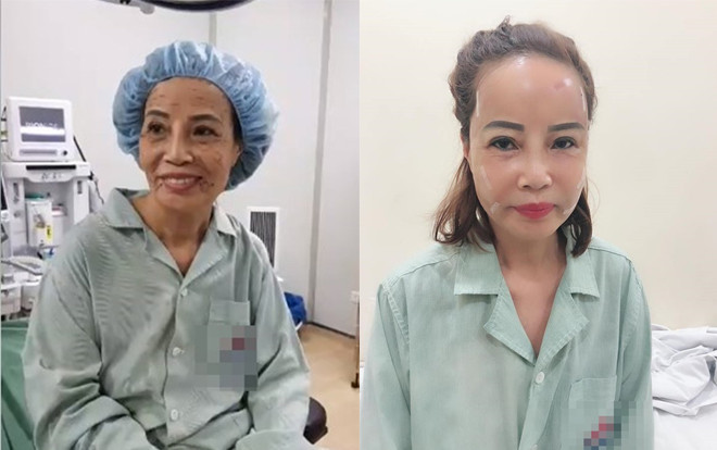 Diện mạo mới gây bất ngờ của cô dâu 61 sau phẫu thuật thẩm mỹ: Dân mạng khen trẻ như mới 40 Ảnh 2