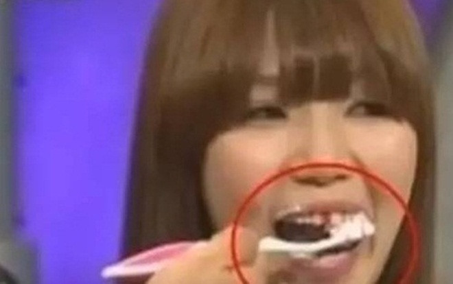 Cô gái 10 năm không đánh răng, khiến bạn trai chia tay vì phát nôn khi vừa mở miệng Ảnh 2