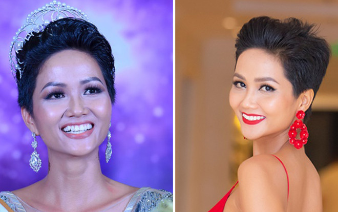 Cái 'kết ngọt' sau khi chỉnh nha đau đớn của hoa hậu H'Hen Niê Ảnh 2