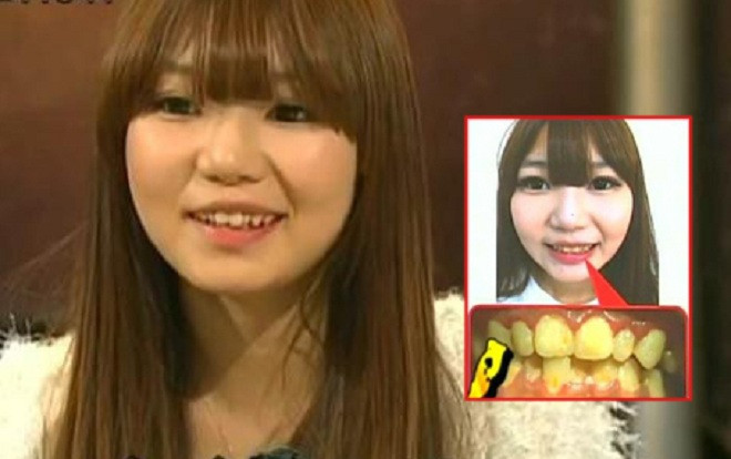 Cô gái xinh đẹp 10 năm không đánh răng khiến bạn trai vừa hôn đã bỏ chạy mất dép Ảnh 2