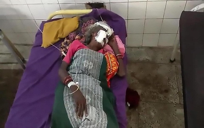 Bà lão bị dân làng cắt lưỡi vì nghi là phù thủy Ảnh 2