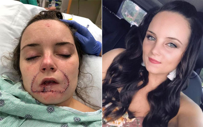 Từ chối quay lại với người yêu cũ, cô gái bị cắn đứt môi Ảnh 2