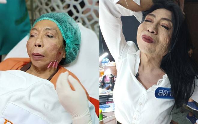 Sốc: 'Thục nữ hot nhất Thái Lan' đi tân trang da mặt nhưng cái kết vẫn cực thê thảm Ảnh 2