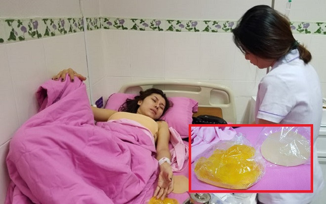 Vụ nổ túi ngực 2.000 USD trên máy bay: Nạn nhân bức xúc tố bác sĩ thẩm mỹ vô tâm, phủ nhận trách nhiệm? Ảnh 2