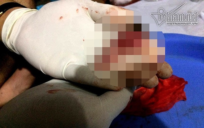 Chàng sinh viên 2 năm đi nhặt 3.000 xác thai nhi Ảnh 2